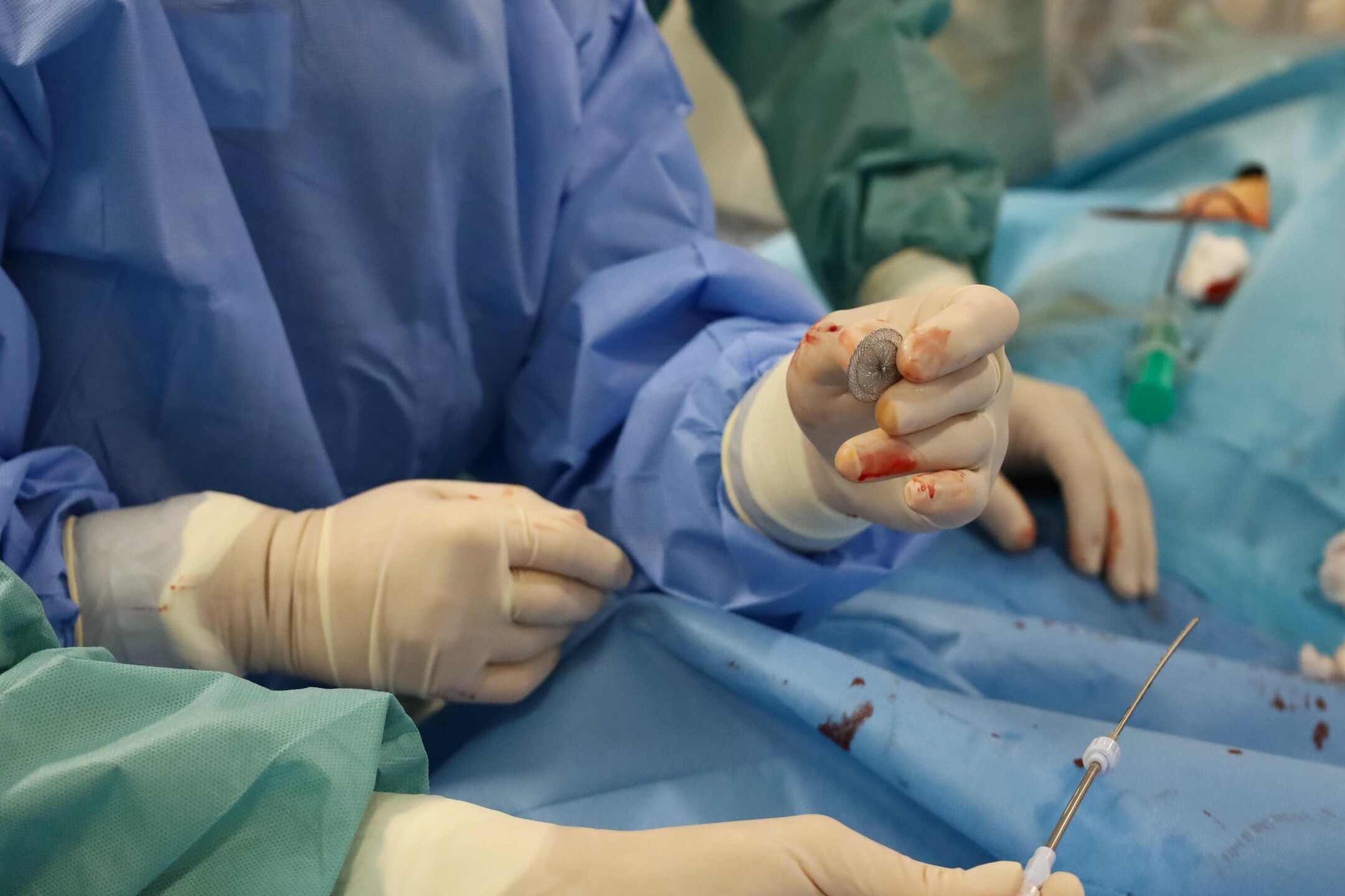 FNsP ZA Podstata výkonu spočíva v zavedení špeciálneho zariadenia do srdca cez cievny prístup