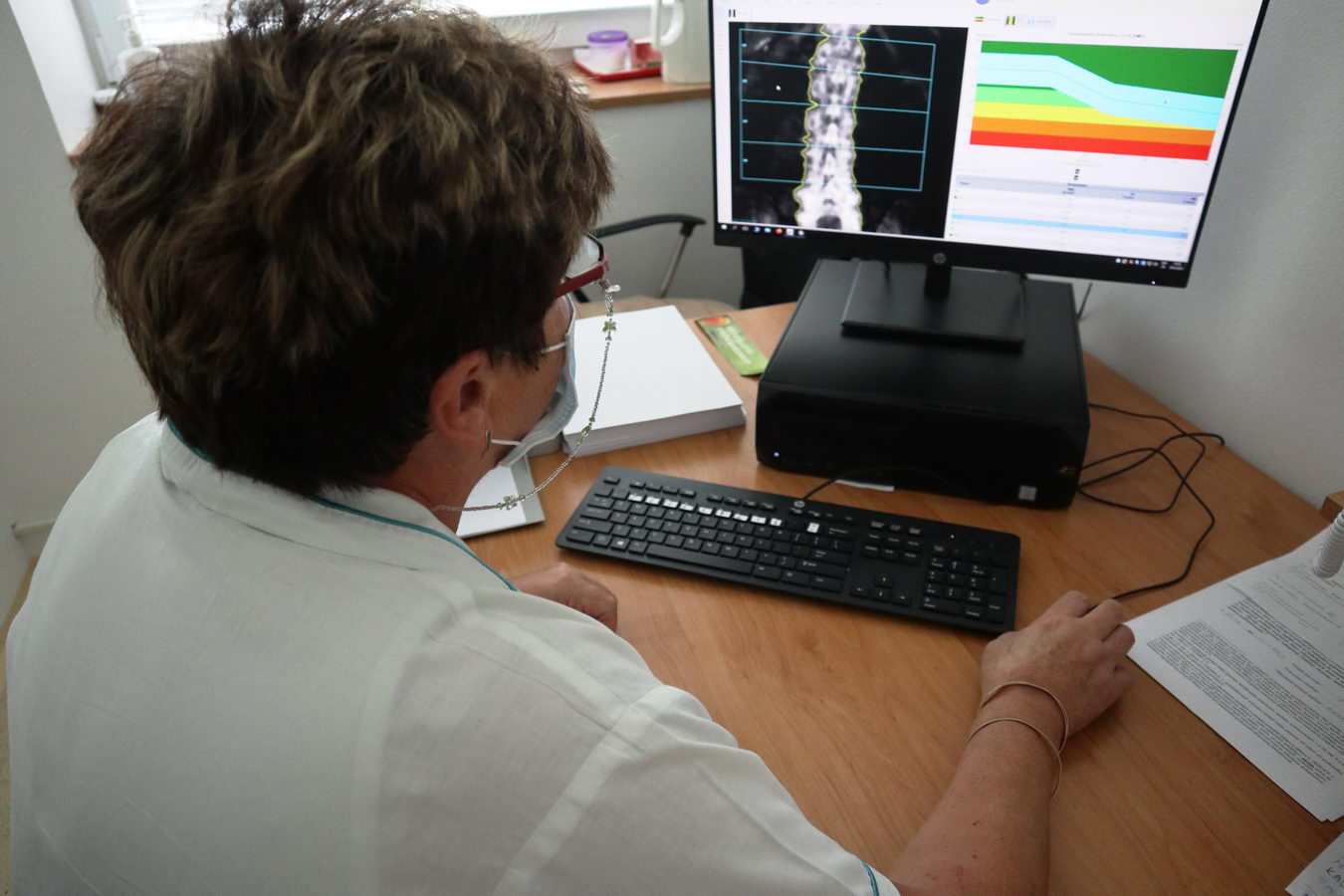 2051 fnsp zadenzitometria je idealna metoda na vcasnu diagnostiku osteoporozy jpg